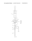 PERIPHERAL BLOOD SAMPLING METHODS AND DEVICES diagram and image