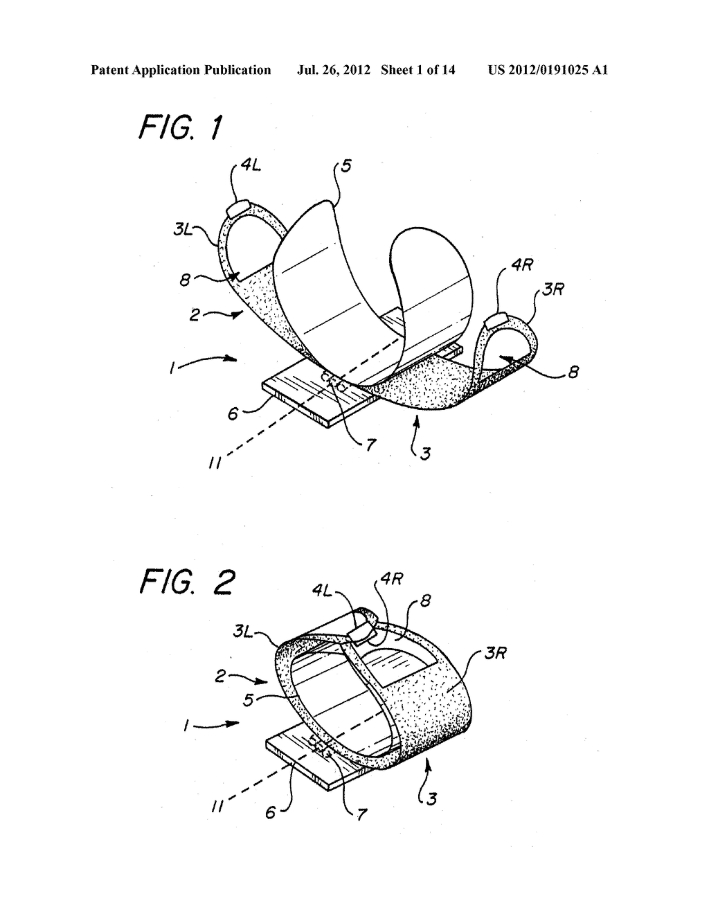 Resuscitation Device and Method - diagram, schematic, and image 02