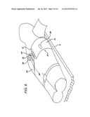 Resuscitation Device and Method diagram and image