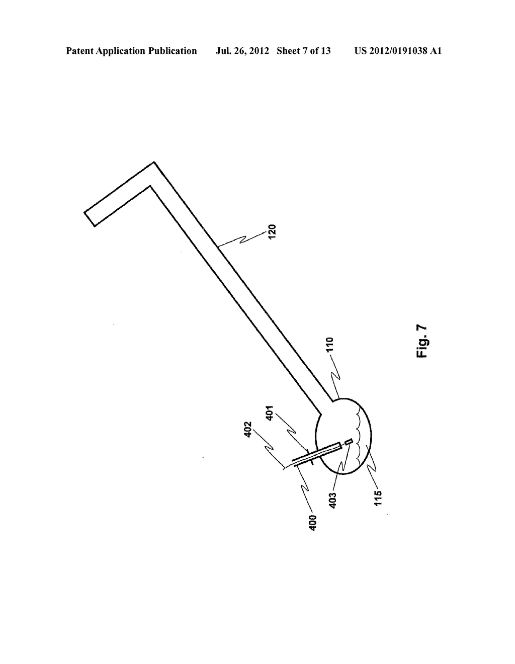 RETROFITTABLE ASPIRATION PREVENTION MECHANISM FOR PATIENTS - diagram, schematic, and image 08