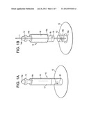 Catheter Attachment and Method diagram and image