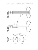 Catheter Attachment and Method diagram and image