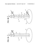 Catheter Attachment and Method diagram and image