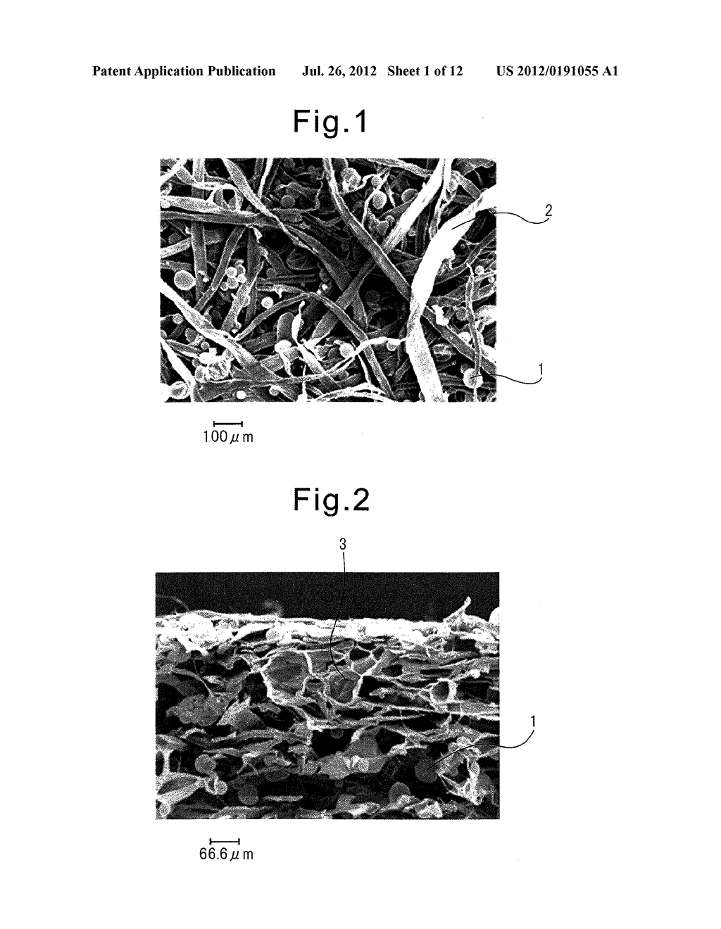 ABSORBENT ARTICLE - diagram, schematic, and image 02