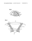 APPARATUS FOR COUPLING AN ELEMENT TO THE EYE diagram and image