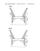 APPARATUS FOR COUPLING AN ELEMENT TO THE EYE diagram and image