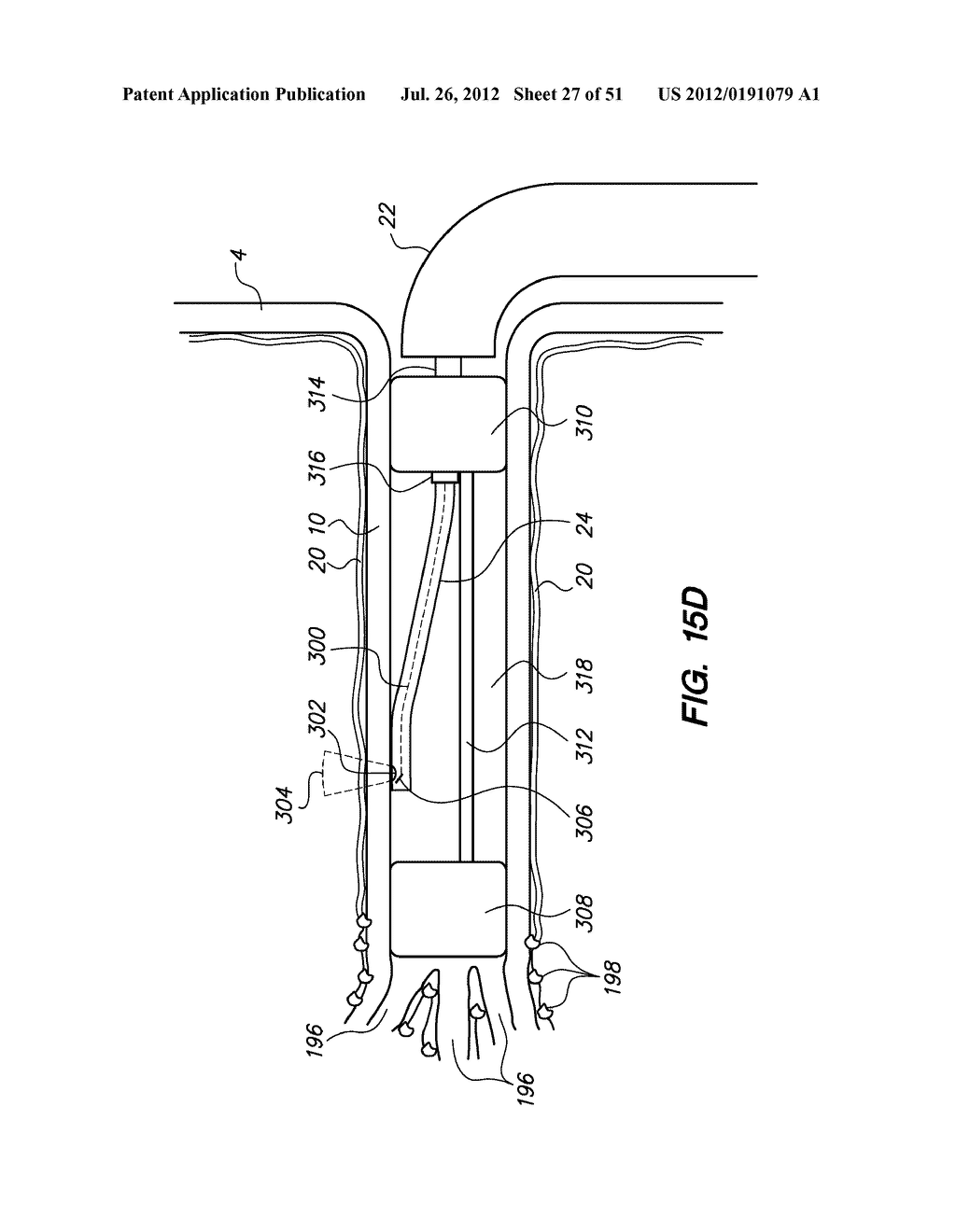 System and method for endoluminal and translumenal therapy - diagram, schematic, and image 28