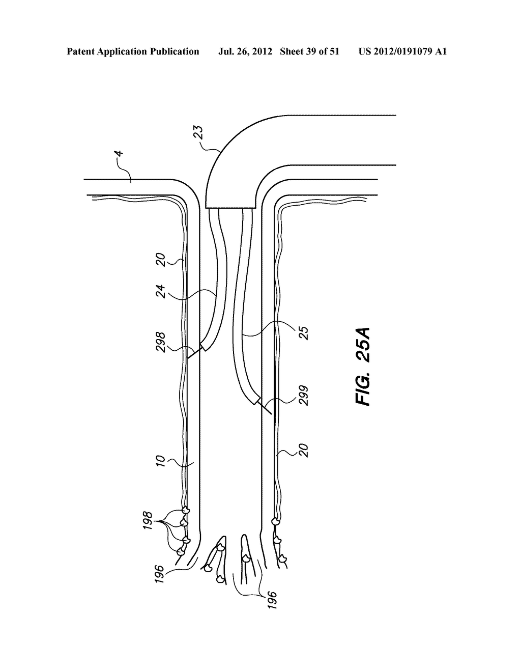 System and method for endoluminal and translumenal therapy - diagram, schematic, and image 40