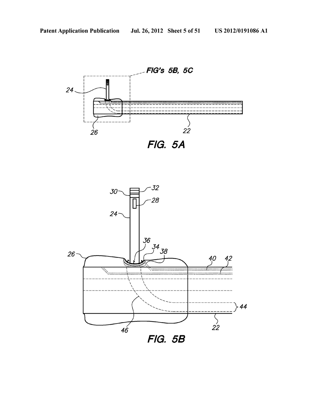 System and method for endoluminal and translumenal therapy - diagram, schematic, and image 06