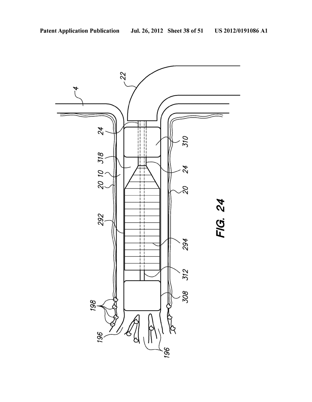 System and method for endoluminal and translumenal therapy - diagram, schematic, and image 39