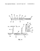 Apparatus and Method for Cutting Costal Cartilage diagram and image