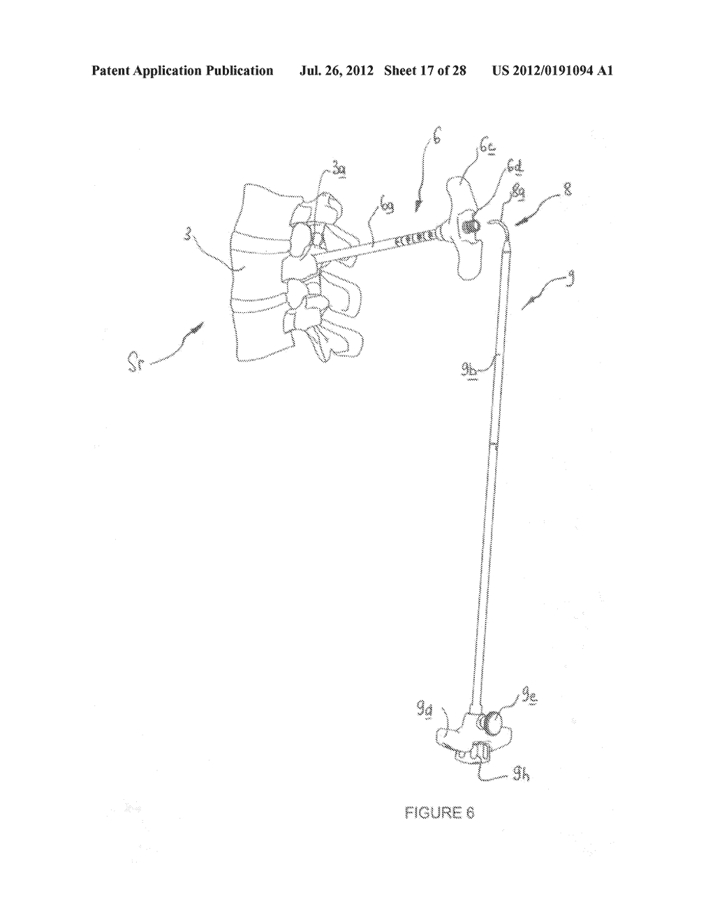 DRILLING DEVICE FOR FORMING A CURVED OSSEOUS CHANNEL WITHIN THE BODY OF A     VERTEBRA - diagram, schematic, and image 18