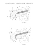 DRILLING DEVICE FOR FORMING A CURVED OSSEOUS CHANNEL WITHIN THE BODY OF A     VERTEBRA diagram and image