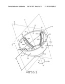 Disposable Surgical Hemispherical Cutter For Concave Surfaces diagram and image