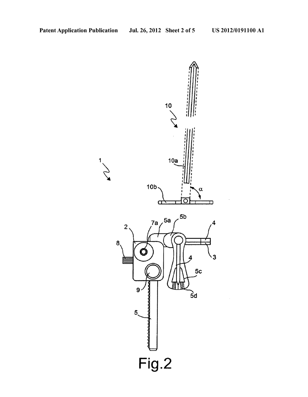 DISTRACTOR DEVICE FOR JOINTS - diagram, schematic, and image 03