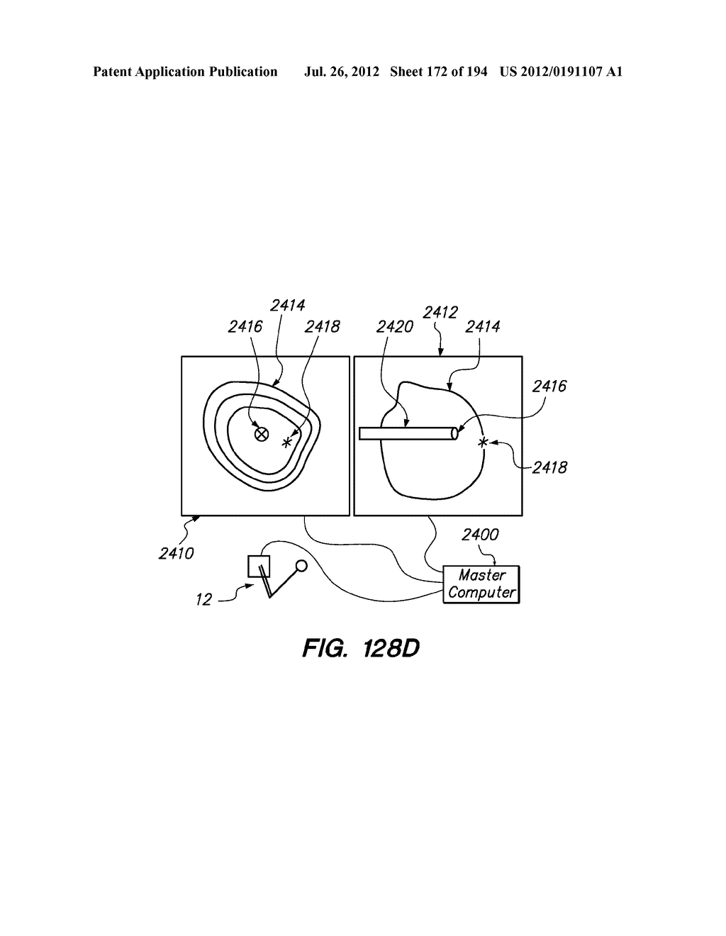 SYSTEMS AND METHODS FOR POSITIONING AN ELONGATE MEMBER INSIDE A BODY - diagram, schematic, and image 173