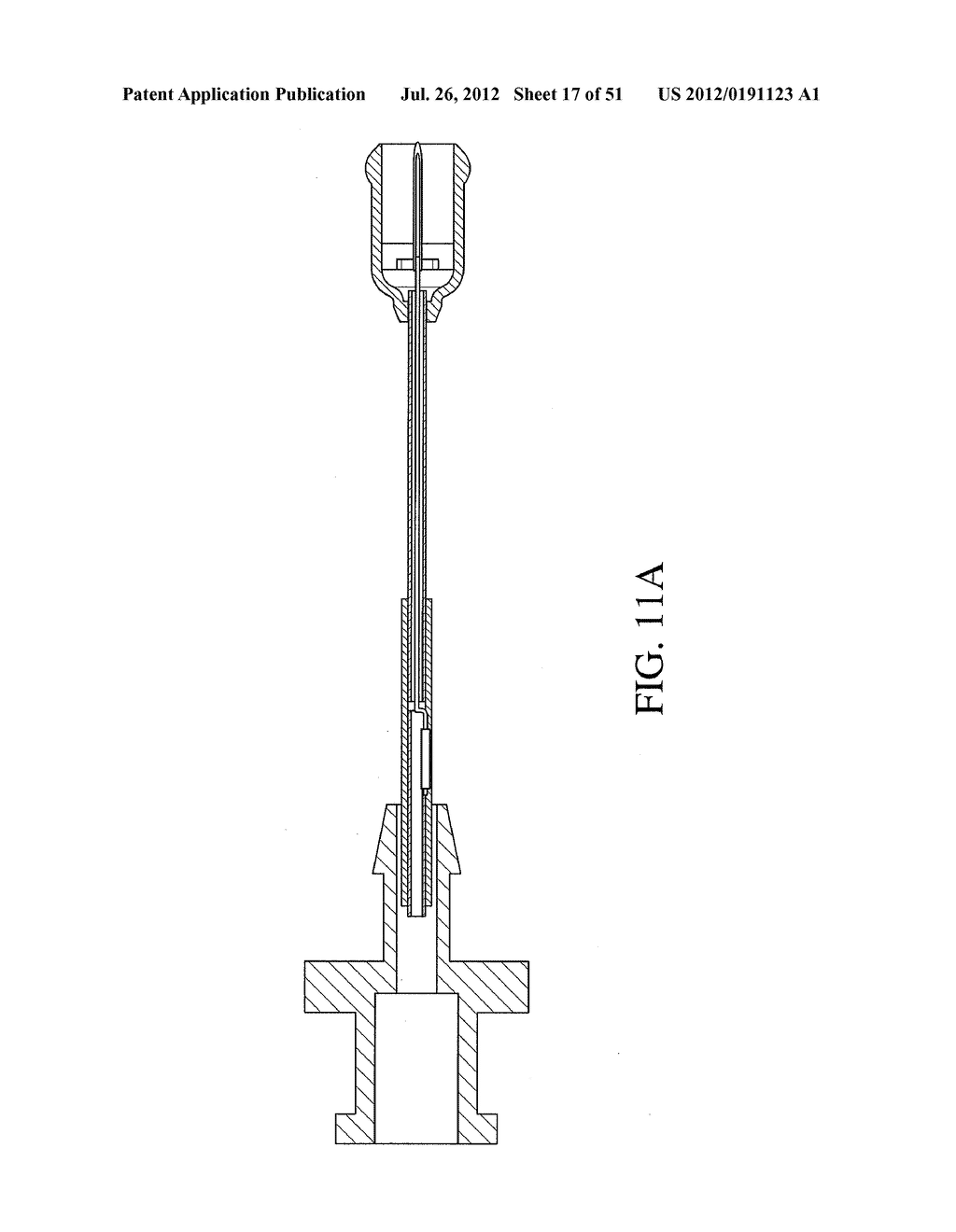 INTRAGASTRIC DEVICE - diagram, schematic, and image 18