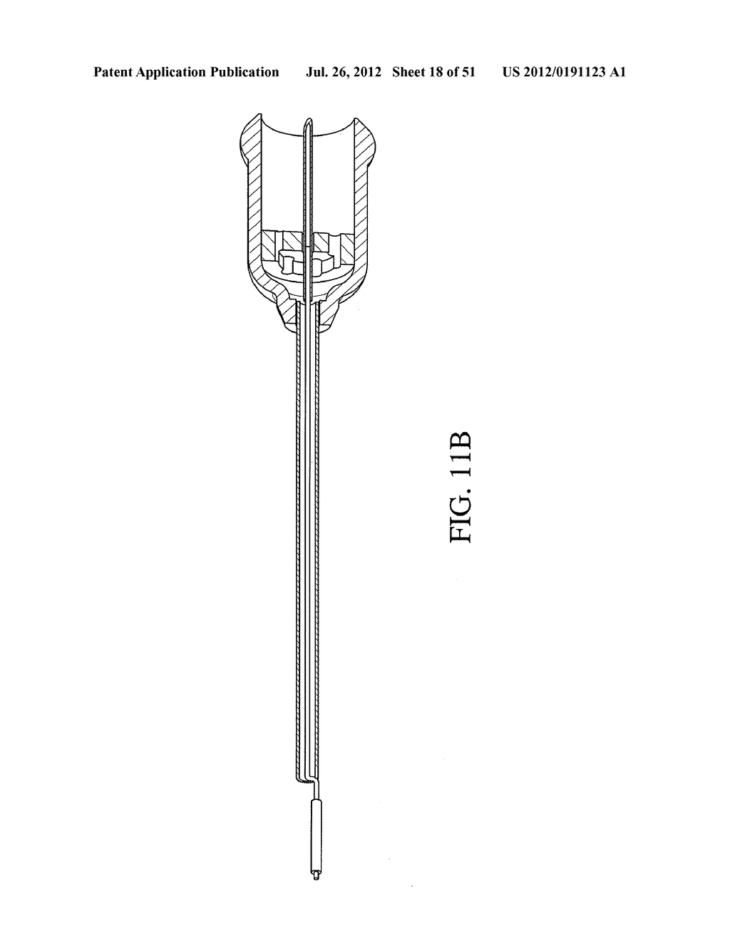 INTRAGASTRIC DEVICE - diagram, schematic, and image 19