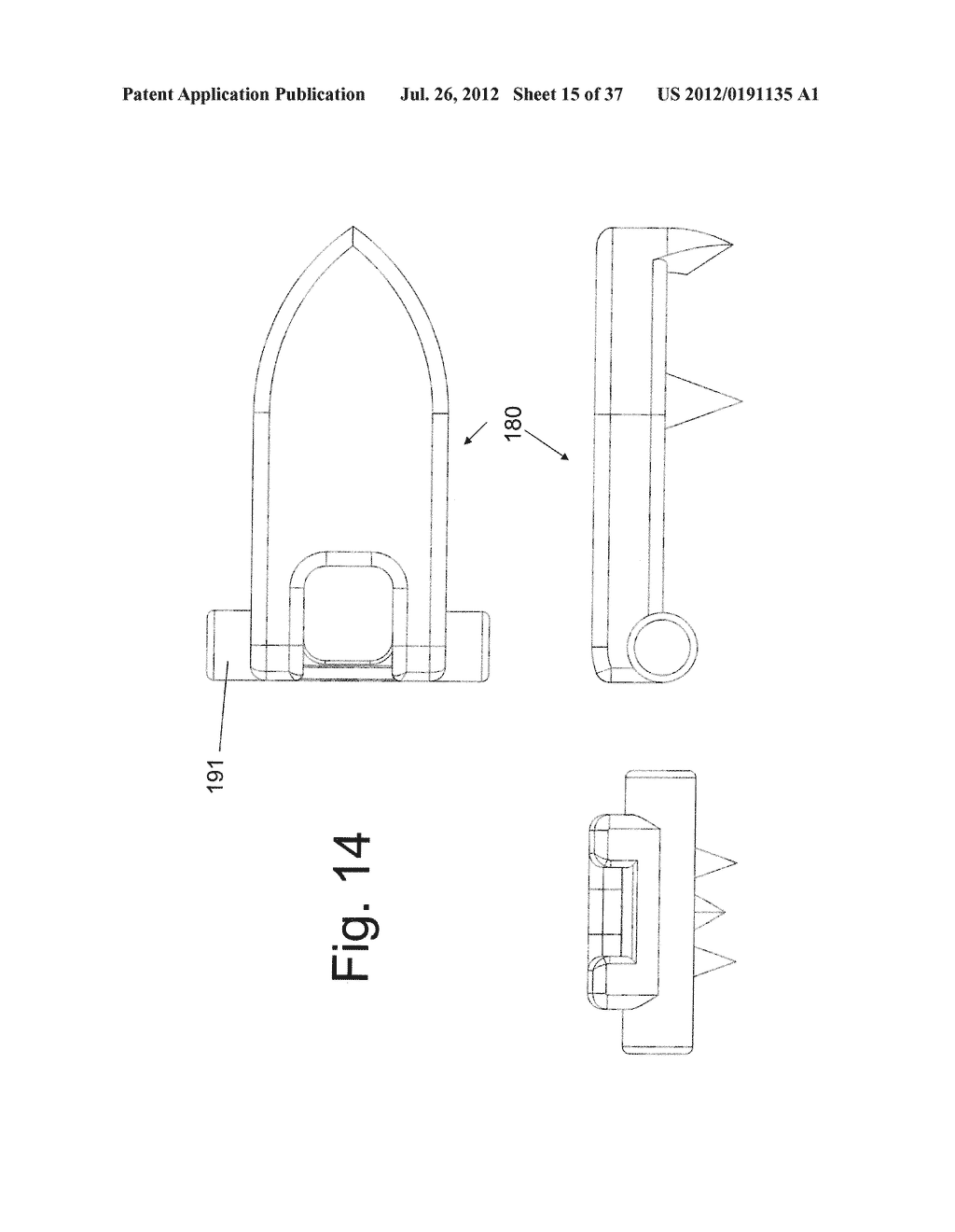 SPINOUS PROCESS FIXATION DEVICES AND METHODS OF USE - diagram, schematic, and image 16