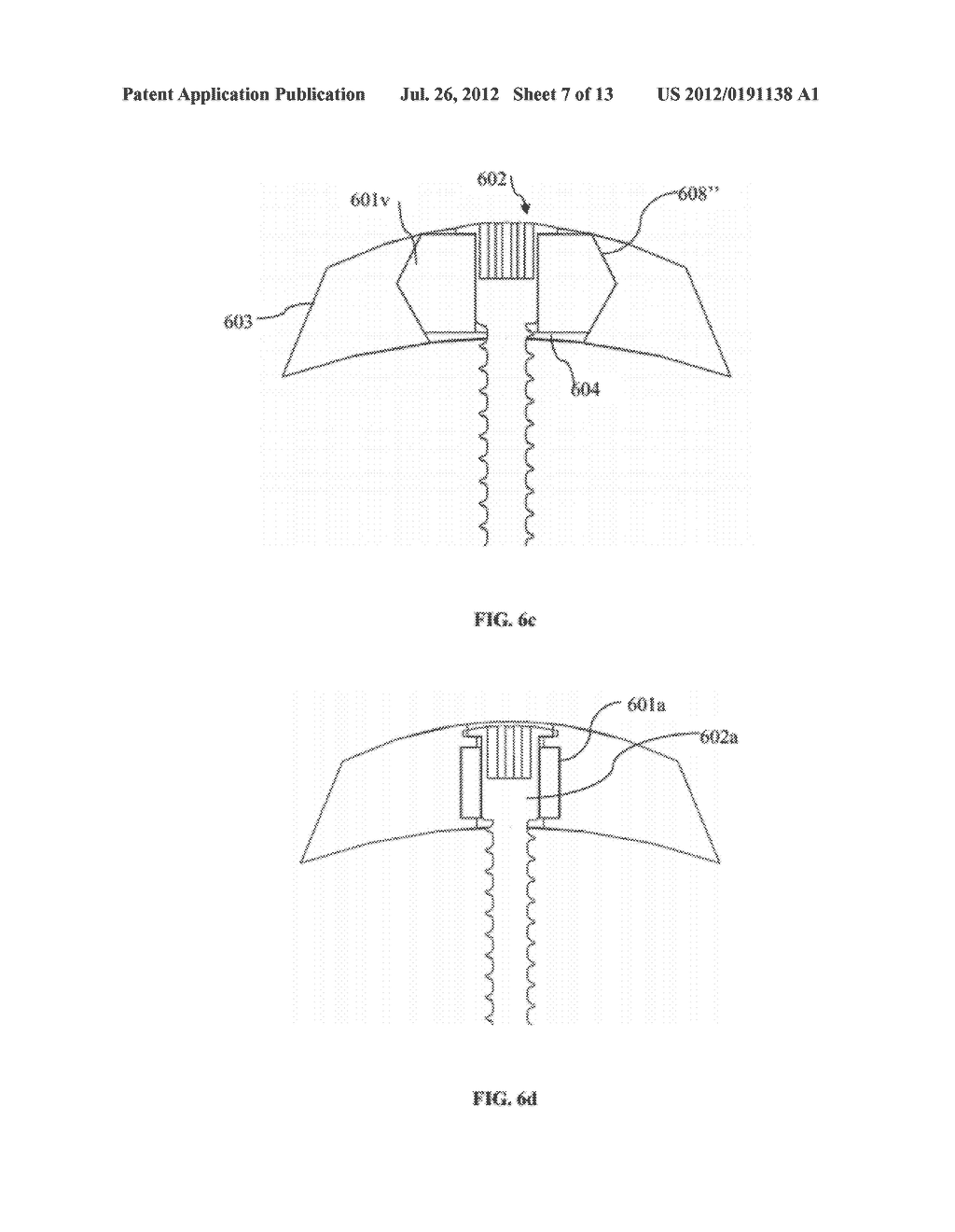 USE OF FLEXIBLE BUSHINGS TO PROMOTE HEALING AND STABLE FRACTURE     COMPRESSION IN ORTHOPEDIC TRAUMA PLATES - diagram, schematic, and image 08