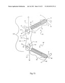 METHODS FOR BONE ALIGNMENT diagram and image