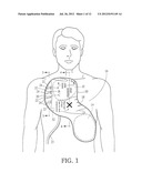 Integrated Resuscitation diagram and image