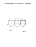 IMPLANTABLE CARDIAC DEVICES AND METHODS diagram and image