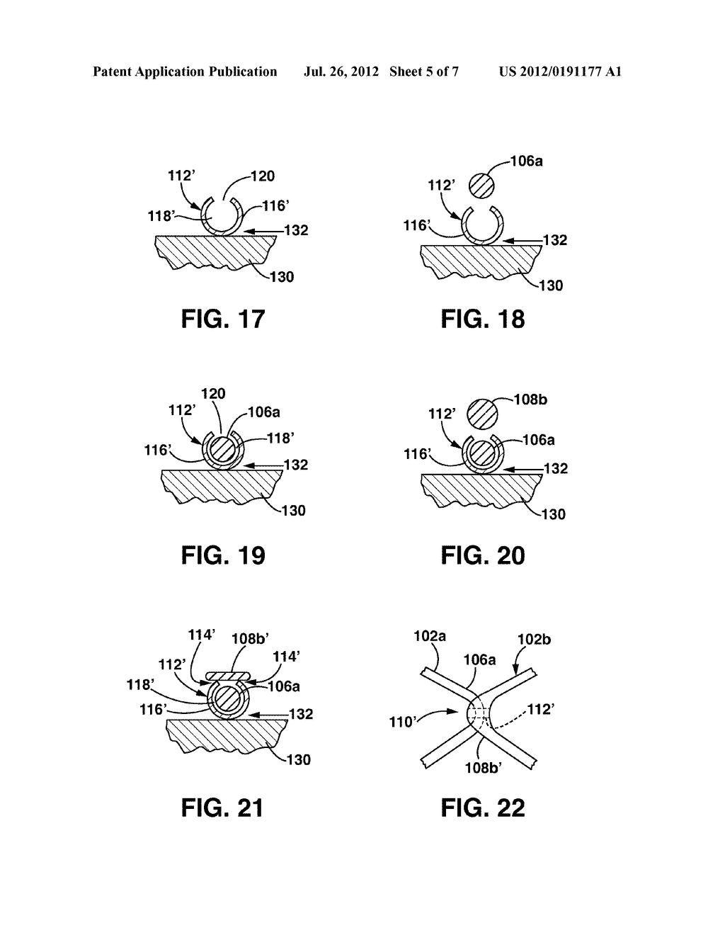 Tubular Helical Stent With Rotatable Connections and Method of Making - diagram, schematic, and image 06