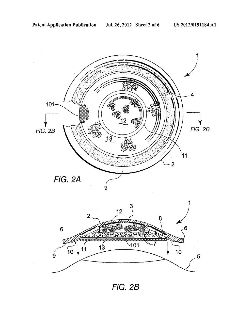 CULTURED TISSUE TRANSPLANT DEVICE - diagram, schematic, and image 03