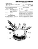 NUCLEUS AUGMENTATION DELIVERY DEVICE AND TECHNIQUE diagram and image