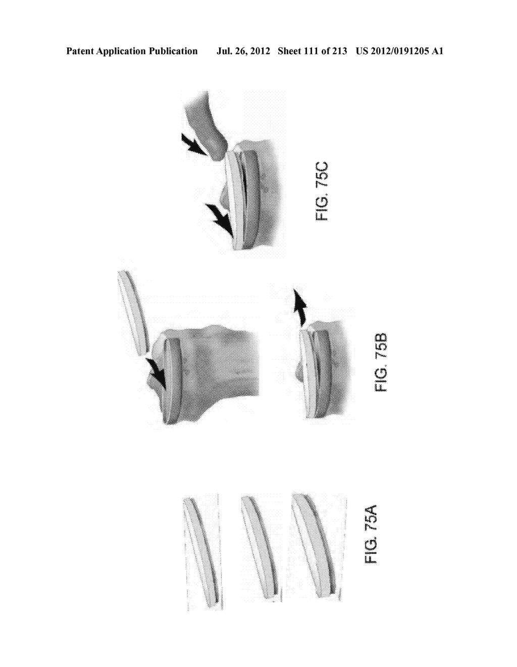 Patient-adapted and improved articular implants, designs and related guide     tools - diagram, schematic, and image 113