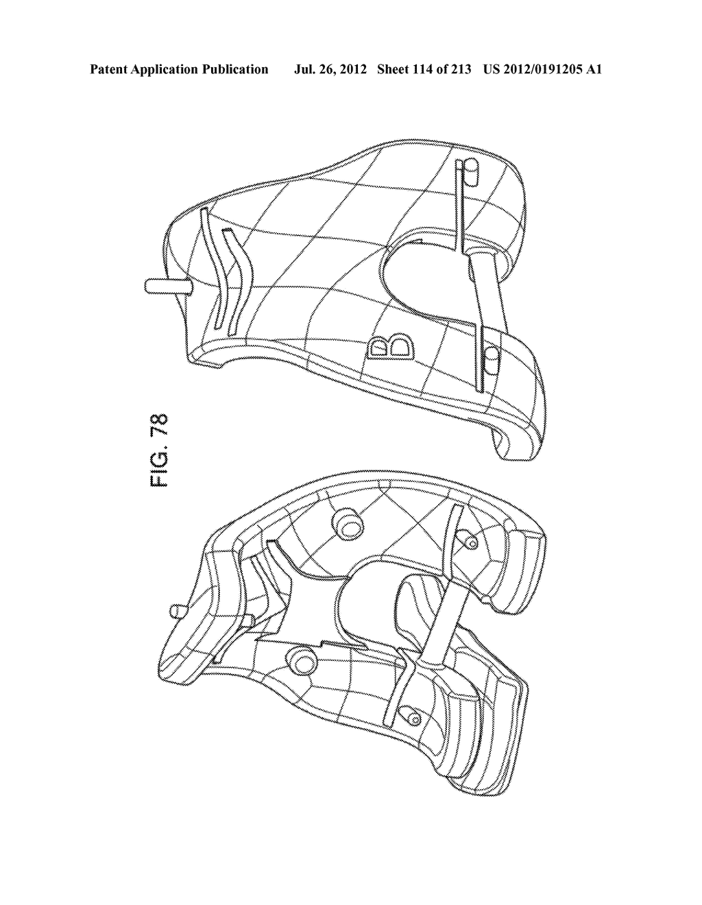 Patient-adapted and improved articular implants, designs and related guide     tools - diagram, schematic, and image 116