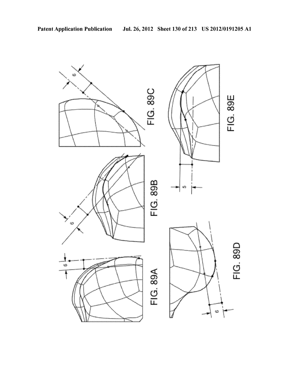 Patient-adapted and improved articular implants, designs and related guide     tools - diagram, schematic, and image 132