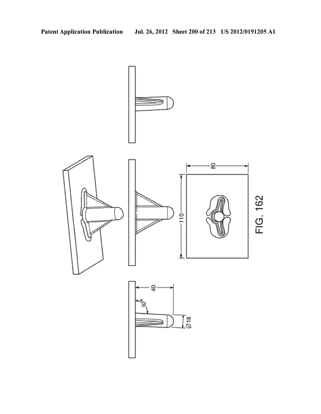 Patient-adapted and improved articular implants, designs and related guide     tools - diagram, schematic, and image 202