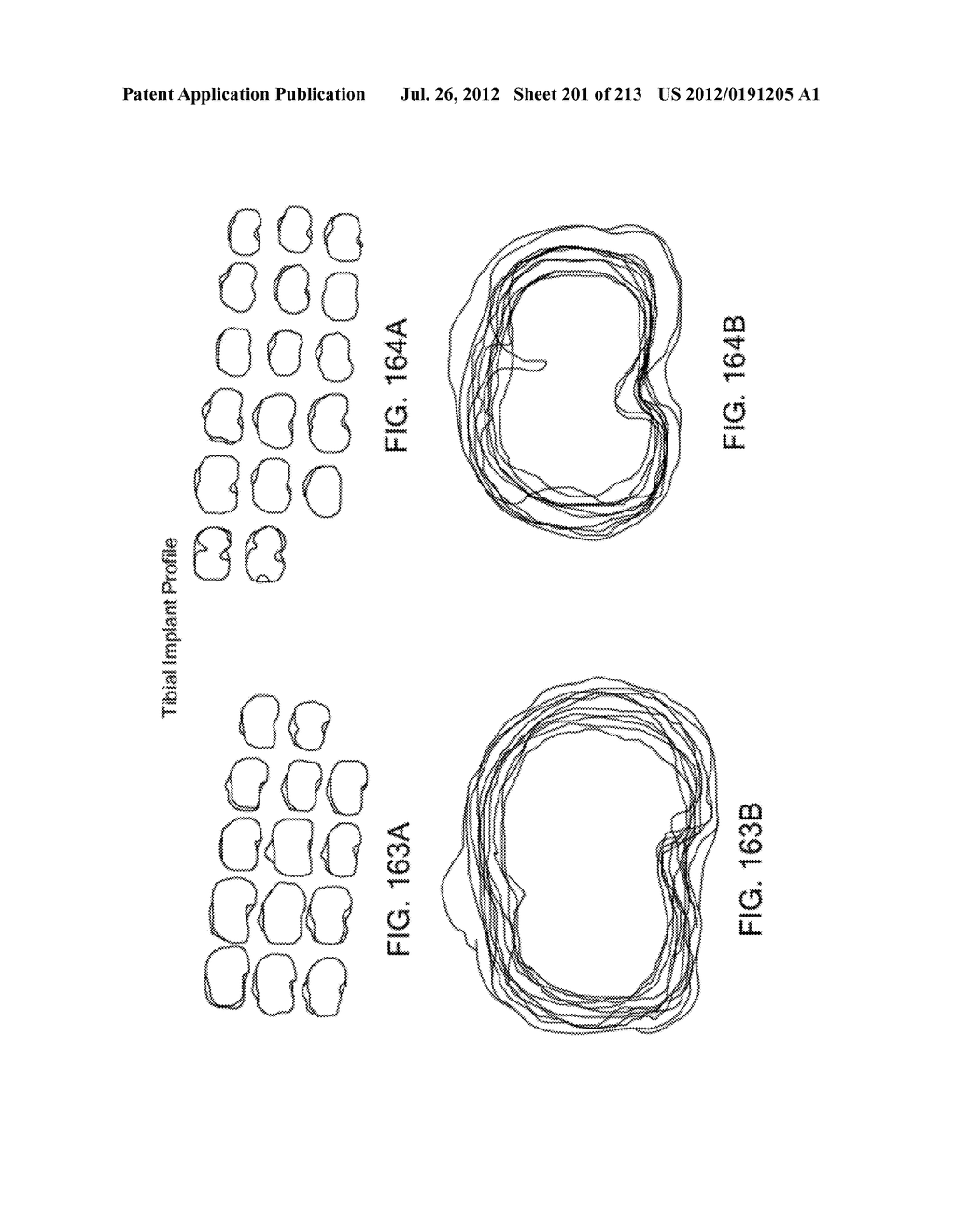 Patient-adapted and improved articular implants, designs and related guide     tools - diagram, schematic, and image 203