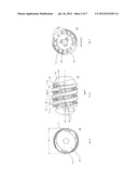 Spherical Subtalar Implant diagram and image