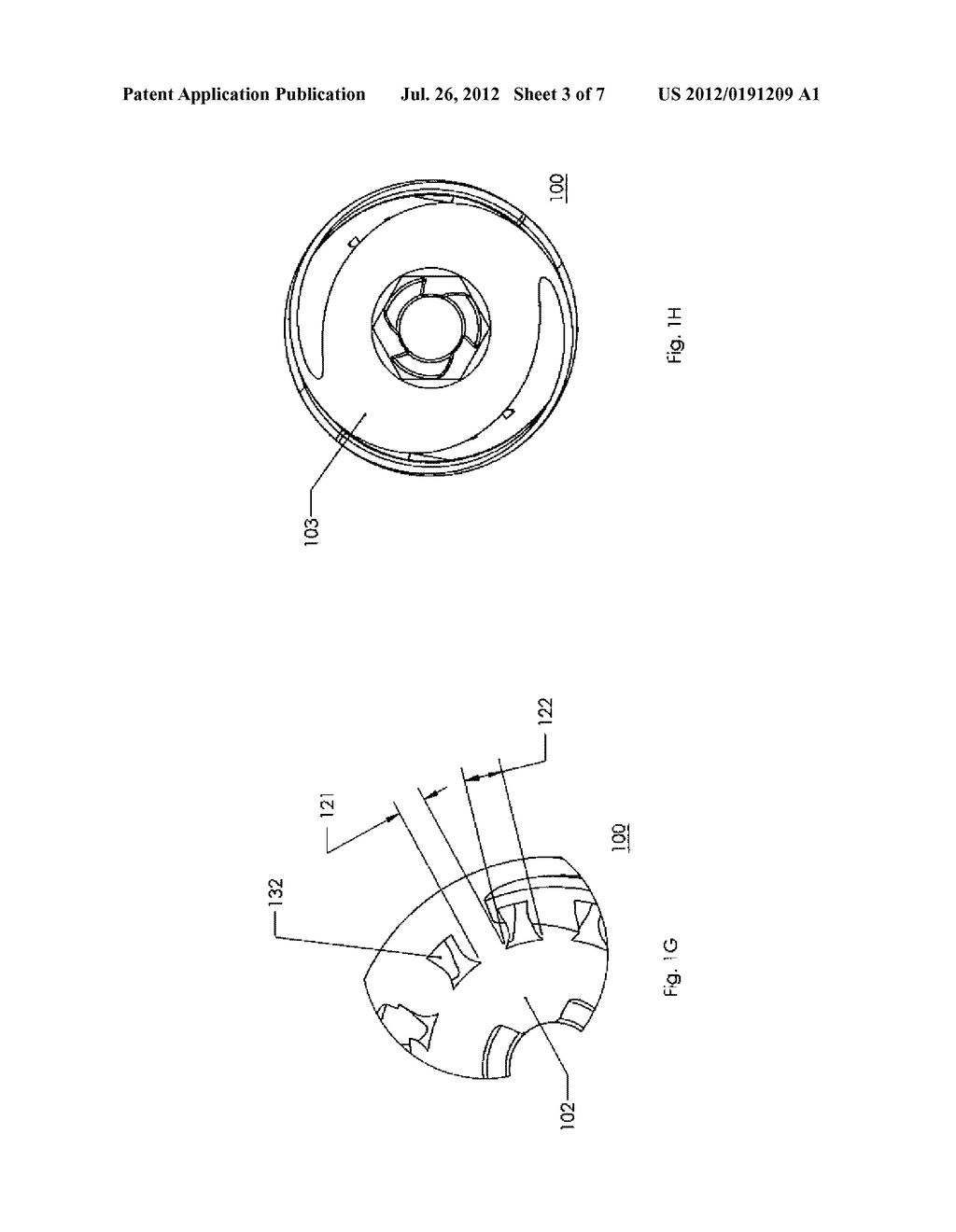 Spherical Subtalar Implant - diagram, schematic, and image 04