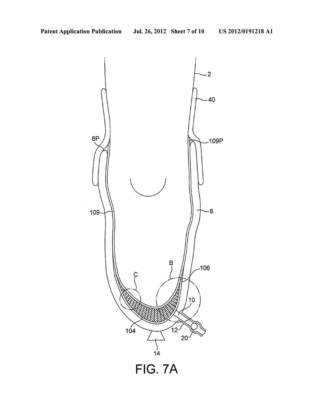 Suspension Device for a Limb Prosthesis or Orthosis - diagram, schematic, and image 08