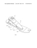 INSTRUMENTED PROSTHETIC FOOT diagram and image