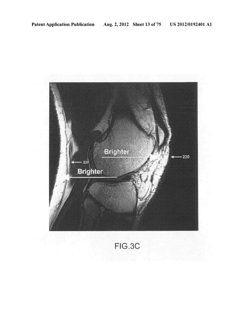 System and method for image segmentation in generating computer models of     a joint to undergo arthroplasty - diagram, schematic, and image 14