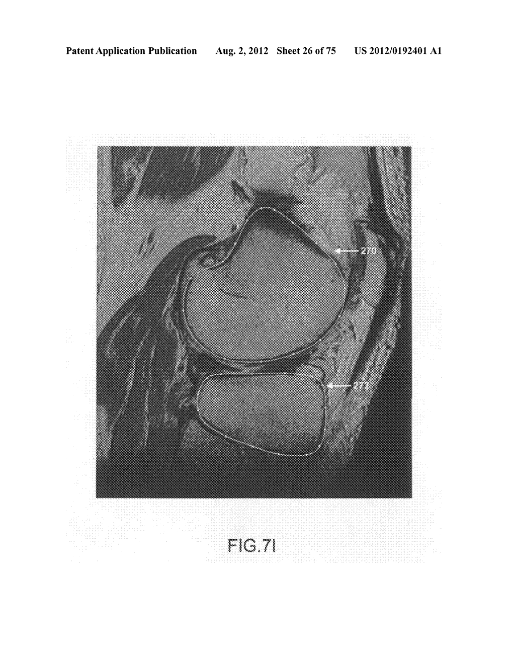 System and method for image segmentation in generating computer models of     a joint to undergo arthroplasty - diagram, schematic, and image 27