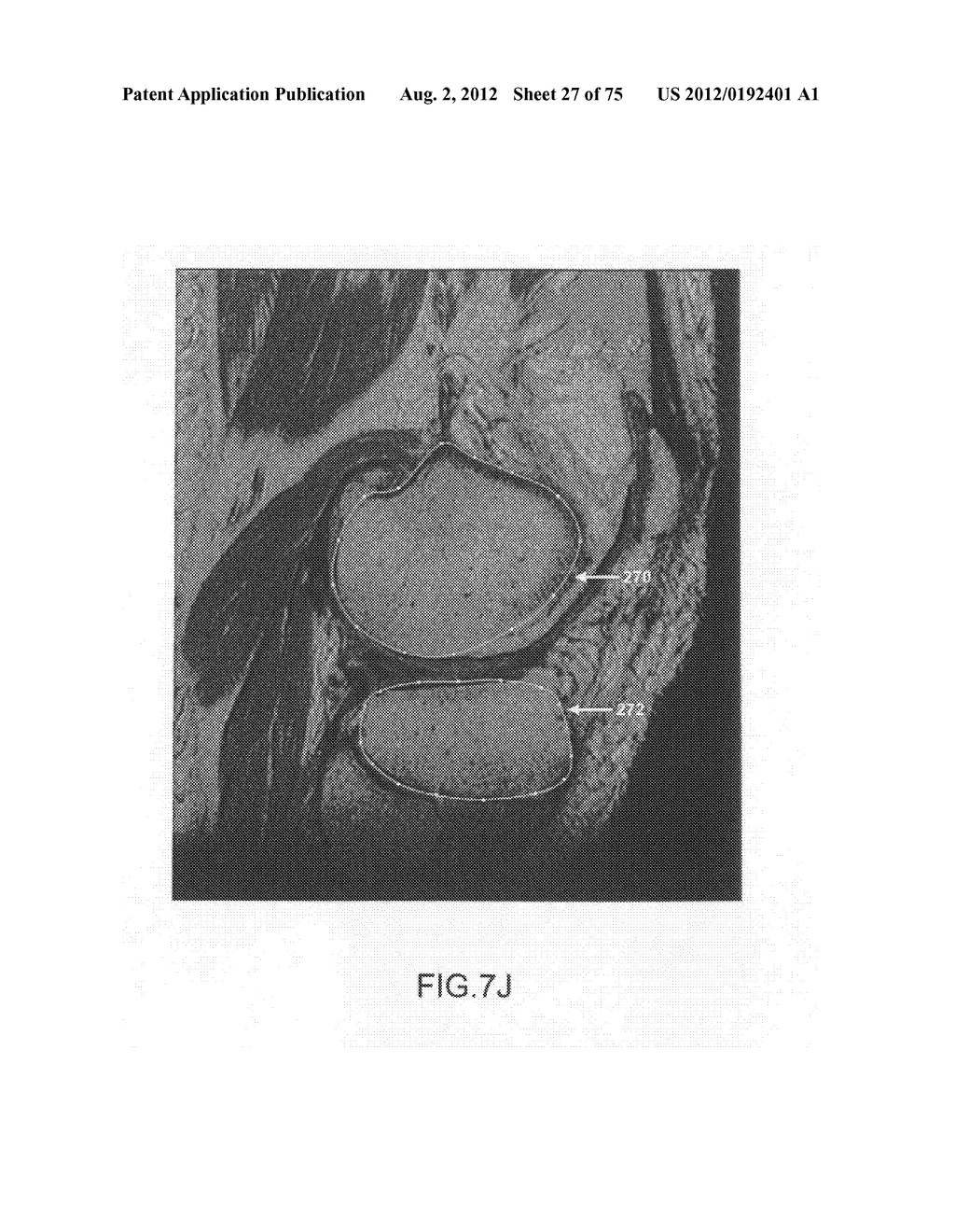 System and method for image segmentation in generating computer models of     a joint to undergo arthroplasty - diagram, schematic, and image 28