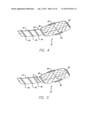 Flexible Circuit Electrode Array diagram and image