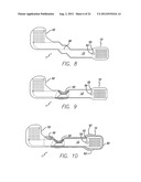 Flexible Circuit Electrode Array diagram and image