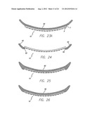 Flexible Circuit Electrode Array diagram and image