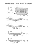 Flexible Circuit Electrode Array diagram and image