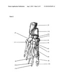 OUTER SOLE FOR SHOES AND SHOES COMPRISING SUCH OUTER SOLES diagram and image