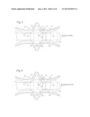 OPERATION DEVICE OF SHIFT MECHANISM IN MANUAL TRANSMISSION diagram and image