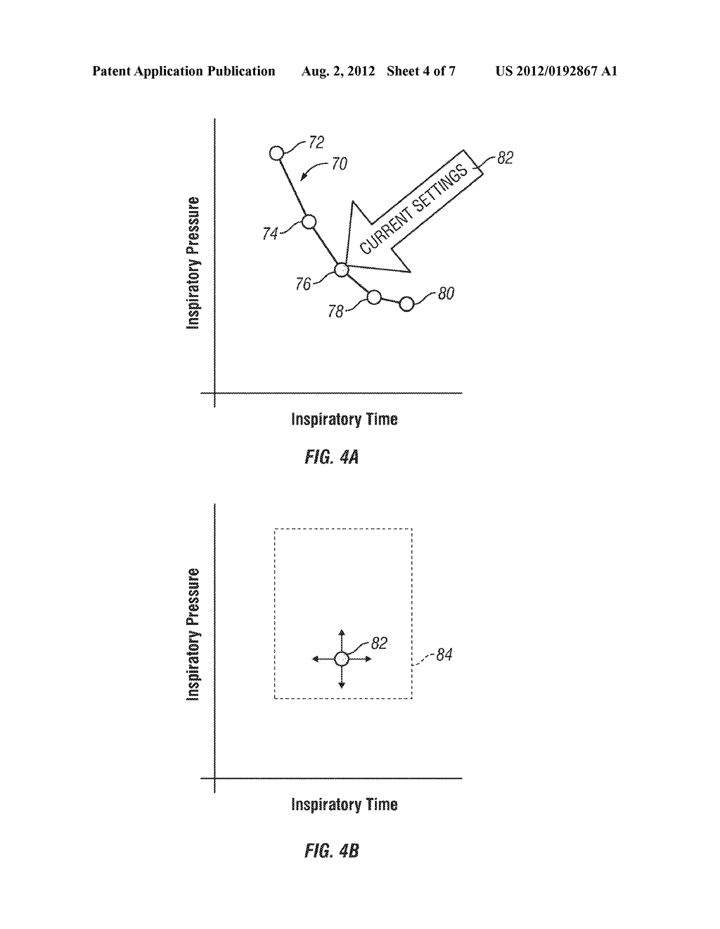 PATIENT-CONTROLLED VENTILATION - diagram, schematic, and image 05