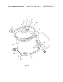 De-Airing Oxygenator for Treating Blood in an Extracorporeal Blood Circuit diagram and image